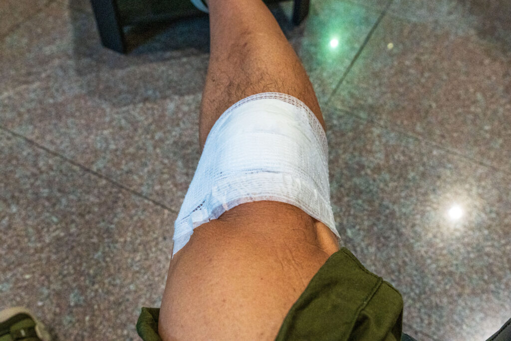 包帯を巻いた足